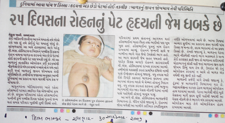 25 days old Rohan's stomach is pumping like heart