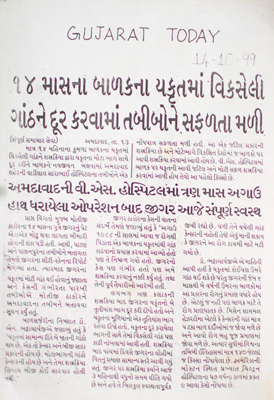 Developed knot in liver of 14 month old child removed successfully